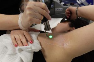 best laser hair removal in Birmingham at Hush Beauty Salon