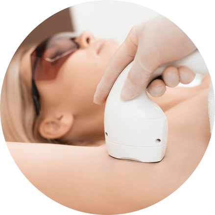 LASER HAIR REMOVAL