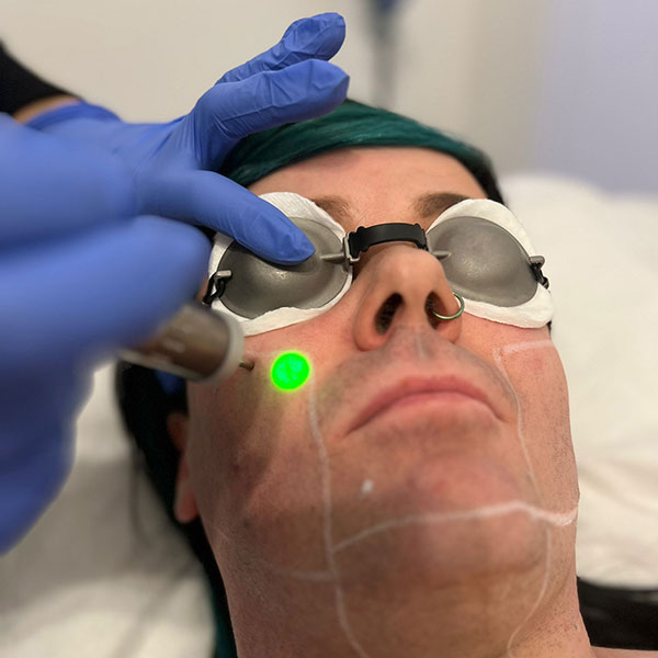 Best Birmingham Laser clinic Birmingham Laser Clinic