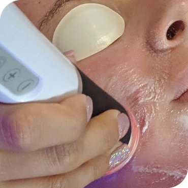 STEP 2, Hydrofacial at HUSH Salon Birmingham HydrO2 Facial Treatment HUSH Birmingham