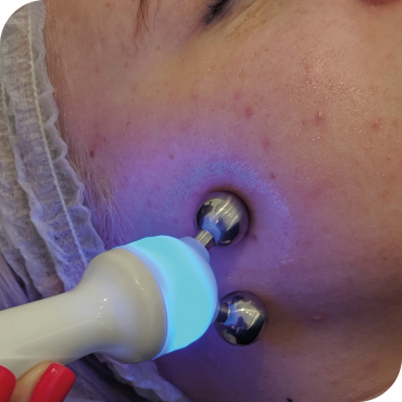 STEP 4, Hydrofacial at HUSH Salon Birmingham HydrO2 Facial Treatment HUSH Birmingham