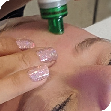 Step 1, Hydrofacial at HUSH Salon Birmingham HydrO2 Facial Treatment HUSH Birmingham