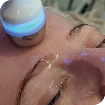 Step 6, Hydrofacial at HUSH Salon Birmingham HydrO2 Facial Hydration Hush Birmingham